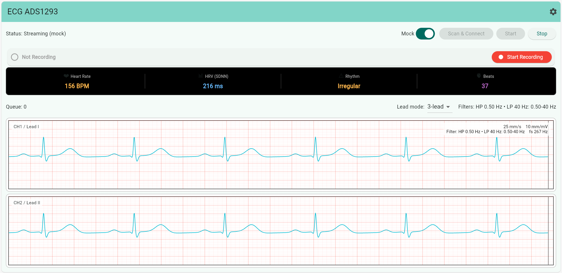 PulseWave app showing live ECG waveforms on two channels with heart rate, QRS duration, and rhythm metrics